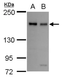 Anti-BLM antibody [N1N2], N-term used in Western Blot (WB). GTX101403