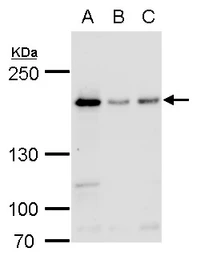 Anti-BLM antibody [N1N2], N-term used in Western Blot (WB). GTX101403
