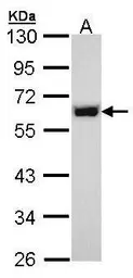 Anti-p54nrb antibody used in Western Blot (WB). GTX101419
