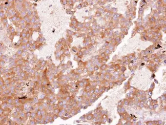 Anti-EIF3D antibody used in IHC (Paraffin sections) (IHC-P). GTX101424