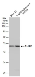 Anti-ALDH2 antibody used in Western Blot (WB). GTX101429