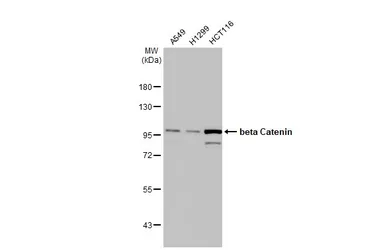 Anti-beta Catenin antibody [N1N2-2], N-term used in Western Blot (WB). GTX101435