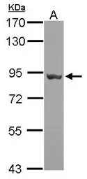 Anti-Hsp90 beta antibody used in Western Blot (WB). GTX101448