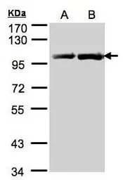 Anti-Hsp90 beta antibody used in Western Blot (WB). GTX101448