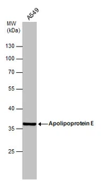 Anti-Apolipoprotein E antibody used in Western Blot (WB). GTX101456