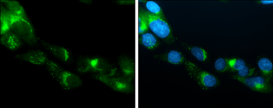 Anti-Apolipoprotein E antibody used in Immunocytochemistry/ Immunofluorescence (ICC/IF). GTX101456