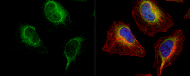 Anti-PDI antibody [N1N3] used in Immunocytochemistry/ Immunofluorescence (ICC/IF). GTX101468