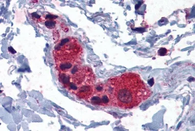 Anti-MYRIP antibody, C-term used in IHC (Paraffin sections) (IHC-P). GTX10149