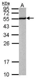 Anti-PABPN1 antibody used in Western Blot (WB). GTX101490