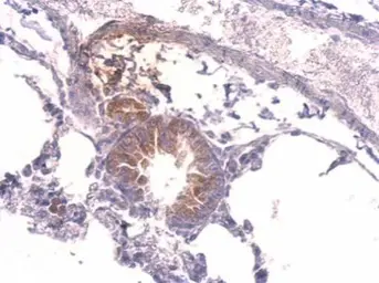 Anti-Tyrosyl tRNA synthetase antibody used in IHC (Paraffin sections) (IHC-P). GTX101492