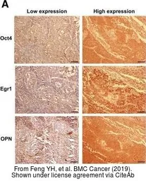 Anti-Oct4 antibody used in IHC (Paraffin sections) (IHC-P). GTX101497