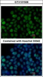 Anti-SOX2 antibody used in Immunocytochemistry/ Immunofluorescence (ICC/IF). GTX101506