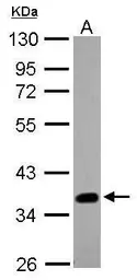 Anti-SOX2 antibody used in Western Blot (WB). GTX101506