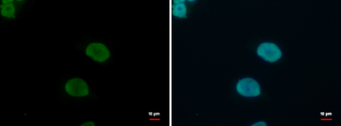 Anti-KLF4 antibody used in Immunocytochemistry/ Immunofluorescence (ICC/IF). GTX101509