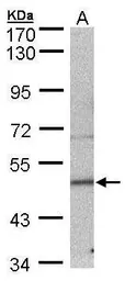 Anti-SEPT7 antibody [N1C1] used in Western Blot (WB). GTX101534