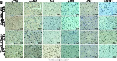 Anti-mTOR antibody [C3], C-term used in IHC (Paraffin sections) (IHC-P). GTX101557