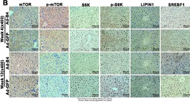 Anti-mTOR antibody [C3], C-term used in IHC (Paraffin sections) (IHC-P). GTX101557