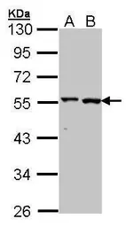 Anti-GPT antibody [N1N3] used in Western Blot (WB). GTX101559