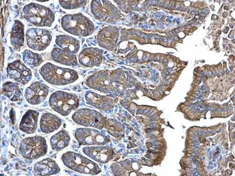 Anti-alpha Adducin antibody used in IHC (Paraffin sections) (IHC-P). GTX101600