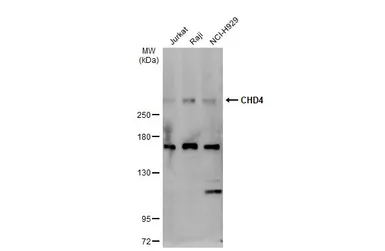 Anti-CHD4 antibody used in Western Blot (WB). GTX101662