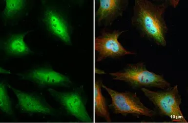 Anti-CHD4 antibody used in Immunocytochemistry/ Immunofluorescence (ICC/IF). GTX101662