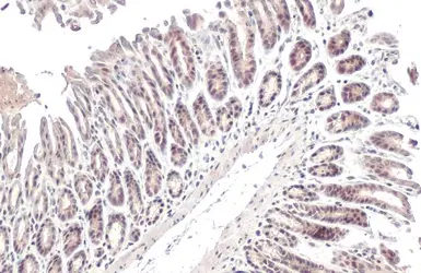 Anti-CHD4 antibody used in IHC (Paraffin sections) (IHC-P). GTX101662