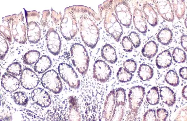 Anti-CHD4 antibody used in IHC (Paraffin sections) (IHC-P). GTX101662