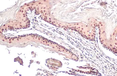 Anti-CHD4 antibody used in IHC (Paraffin sections) (IHC-P). GTX101662