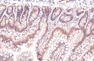 Anti-CHD4 antibody used in IHC (Paraffin sections) (IHC-P). GTX101662