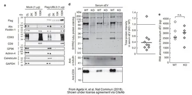 Anti-alpha Actinin 4 antibody [C2C3], C-term used in Western Blot (WB). GTX101669