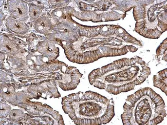 Anti-alpha Actinin 4 antibody [C2C3], C-term used in IHC (Paraffin sections) (IHC-P). GTX101669