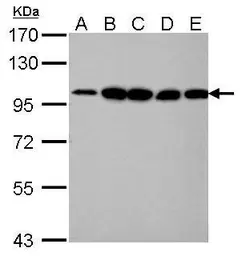 Anti-alpha Actinin 4 antibody [C2C3], C-term used in Western Blot (WB). GTX101669