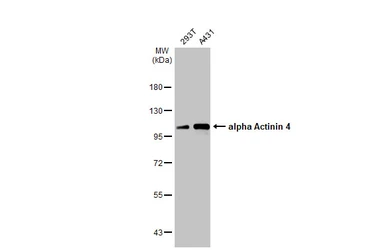 Anti-alpha Actinin 4 antibody [C2C3], C-term used in Western Blot (WB). GTX101669