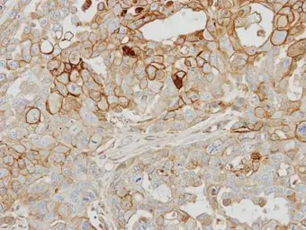 Anti-GRK2 antibody [C2C3], C-term used in IHC (Paraffin sections) (IHC-P). GTX101682