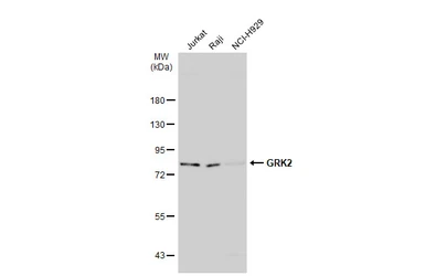 Anti-GRK2 antibody [C2C3], C-term used in Western Blot (WB). GTX101682