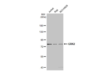 Anti-GRK2 antibody [C2C3], C-term used in Western Blot (WB). GTX101682