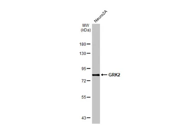 Anti-GRK2 antibody [C2C3], C-term used in Western Blot (WB). GTX101682