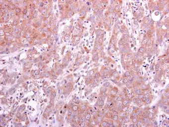 Anti-PGD antibody used in IHC (Paraffin sections) (IHC-P). GTX101704