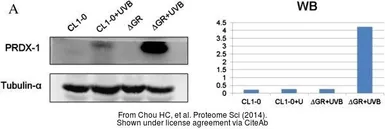 Anti-PRX I antibody [N1C2] used in Western Blot (WB). GTX101705