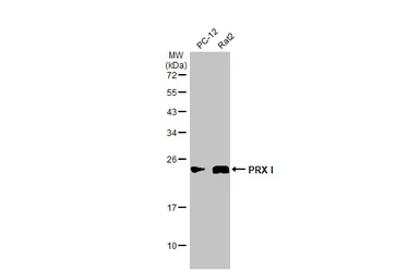 Anti-PRX I antibody [N1C2] used in Western Blot (WB). GTX101705