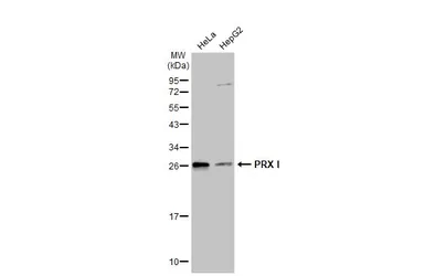 Anti-PRX I antibody [N1C2] used in Western Blot (WB). GTX101705