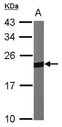 Anti-PRX I antibody [N1C2] used in Western Blot (WB). GTX101705