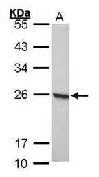 Anti-PRX I antibody [N1C2] used in Western Blot (WB). GTX101705