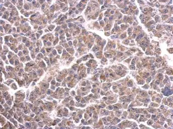 Anti-CYC1 antibody used in IHC (Paraffin sections) (IHC-P). GTX101717