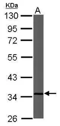 Anti-CYC1 antibody used in Western Blot (WB). GTX101717