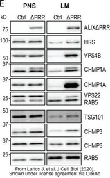 Anti-HGS antibody [C2C3], C-term used in Western Blot (WB). GTX101718