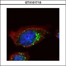 Anti-HGS antibody [C2C3], C-term used in Immunocytochemistry/ Immunofluorescence (ICC/IF). GTX101718
