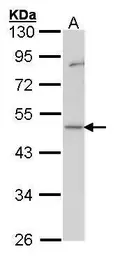 Anti-GDI1 antibody used in Western Blot (WB). GTX101731