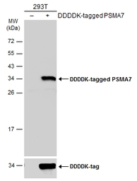 Anti-PSMA7 antibody [N1C3] used in Western Blot (WB). GTX101745