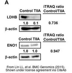 Anti-LDH-B antibody used in Western Blot (WB). GTX101747